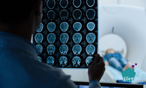 brain scans and Alzheimer's